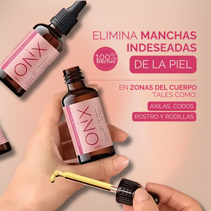 OFERTA TÓNICO ONIX DESPIGMENTANTE + OBSEQUIO JABON PH